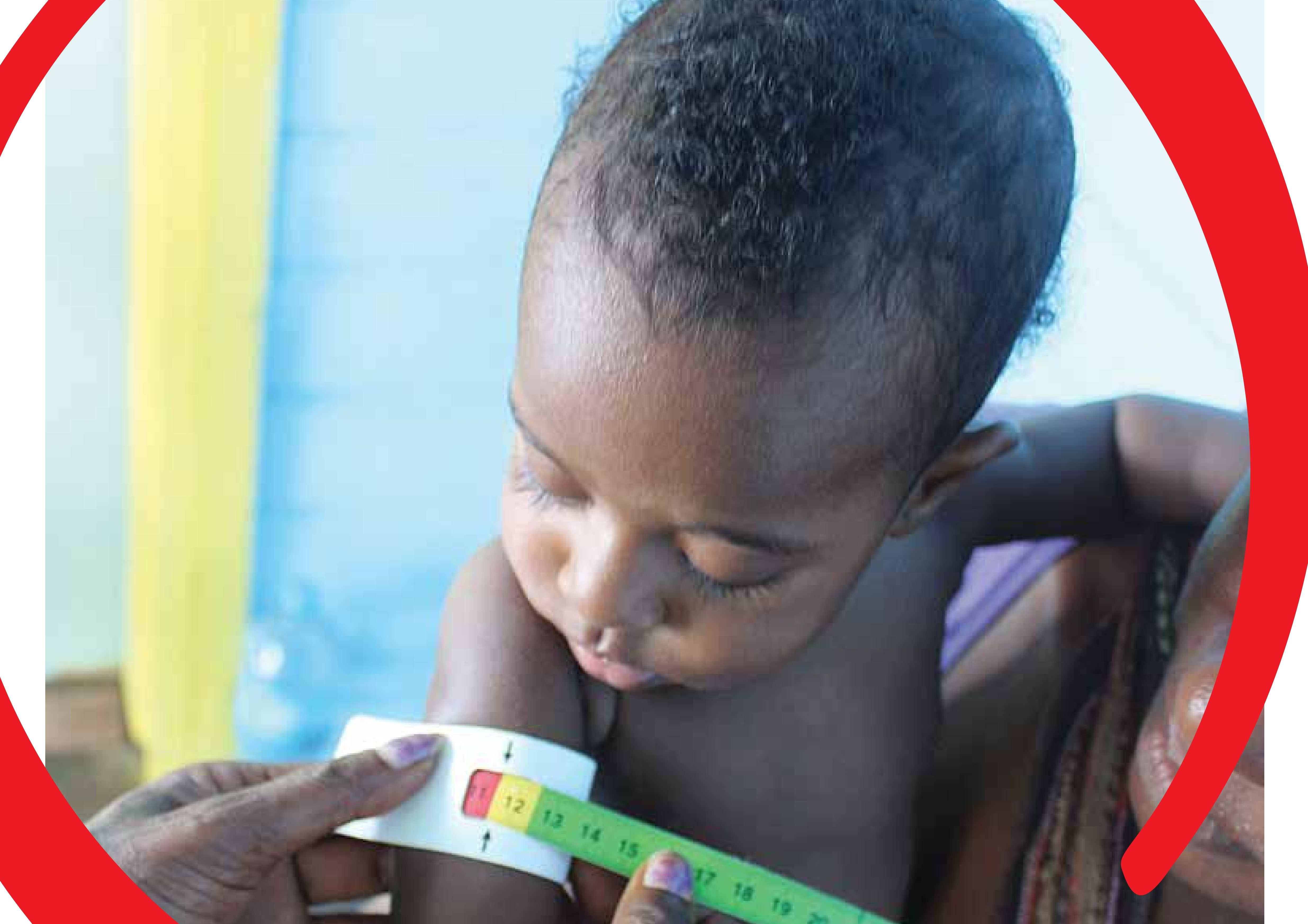 New report reveals child undernutrition costs the PNG economy up to $1.5 billion per year