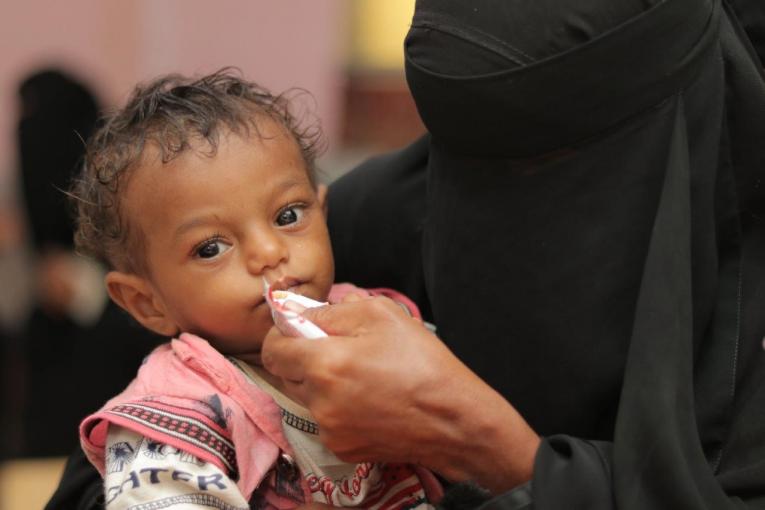 Malnutrition surges among young children in Yemen as conditions worsen